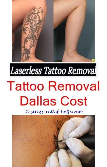 Instead of opting for laser tattoo removal, you can use these ingredients to remove your tattoo naturally. Remove tattoo yourself.How good does laser tattoo removal ...