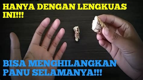 Cara penggunaan aplikasi ini juga sangat mudah anda cukup install dan seluruh iklan menggangu akan sirna. BEST TIPS!!! HANYA DENGAN INI BISA MENGHILANGKAN PANU ...