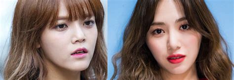 Aoa jimin and mina mp3 & mp4. Tras respuesta de Jimin de AOA, Mina revela cicatrices de ...