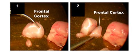 It guides the reader through normal mouse and rat anatomy and histology using direct comparison to human. Proteine Atlas Rat / Anti-LRP2BP Antibody (HPA036665 ...