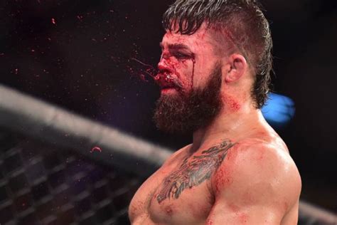 Luque is a married man. Mike Perry posts disturbing video of his bleeding leg