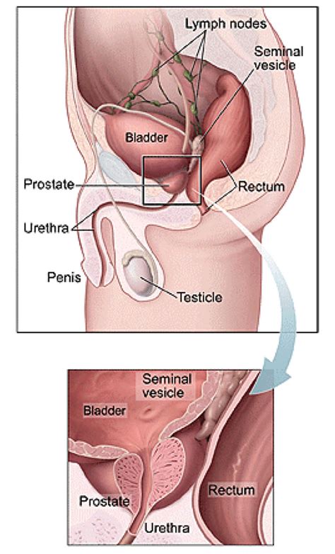 All men are at risk for prostate cancer. Prostate Cancer | Man Up! Australia