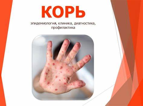 Заболевание толстого кишечника диета Готовые презентации по медицине для студентов и преподавателей на Готовые презентации по медицине для студентов и преподавателей на Заболевание толстого кишечника диета