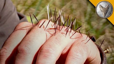 However, the thorns are painful and can cause infections that might if the spines are impossible to remove using tweezers, you might need to go to your local hospital. How To Trap A Porcupine In The Easiest Way With Trap Or Gun