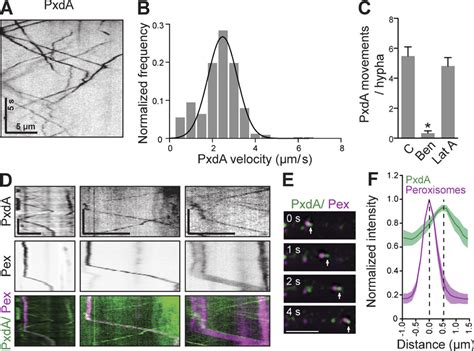 It is used predominantly in building services pipework systems. Microtubule-based movement of PxdA colocalizes with moving ...