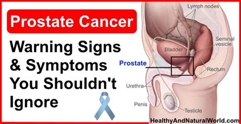 Prostate cancer is a form of cancer that develops in the prostate gland. Prostate Cancer - Warning Signs and Symptoms You Shouldn't ...