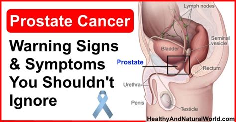 However, prostate cancer warning signs can be hard to spot. Prostate Cancer - Warning Signs and Symptoms You Shouldn't ...