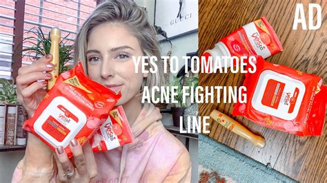 Salicylic acid 5mg in 1ml labeler: YES TO TOMATOES ACNE FIGHTING LINE | Budget Friendly ...