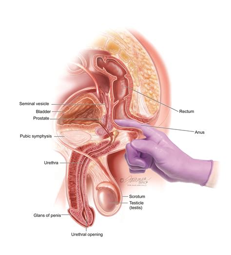 Enjoy our hd porno videos on any device of your choosing! Benign Prostatic Hyperplasia (BPH): Symptoms, Diagnosis ...