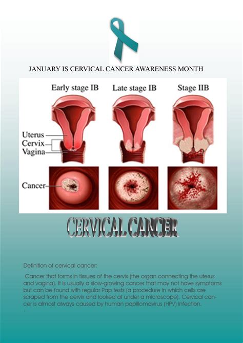 People should discuss prevention and screening measures. WellScript, LLC: Cervical Cancer Awareness Month