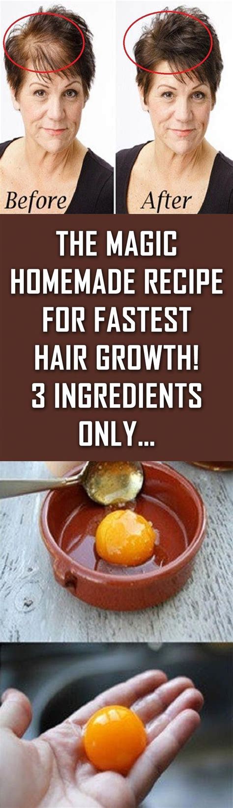 Want stronger and healthier hair? The Magic Homemade Recipe For Fastest Hair Growth! 3 ...