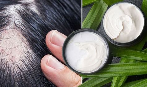 Looking for an old soul like myself. Best hair loss treatment: Melatonin may stop alopecia ...