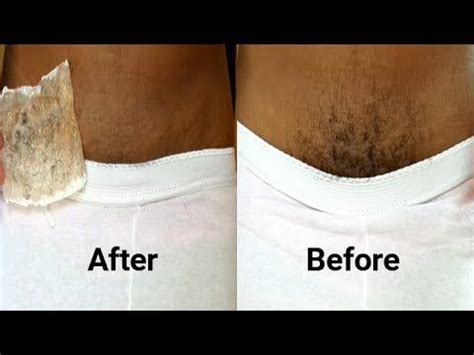 Pubic hair removal cream reviews Pin on Skin