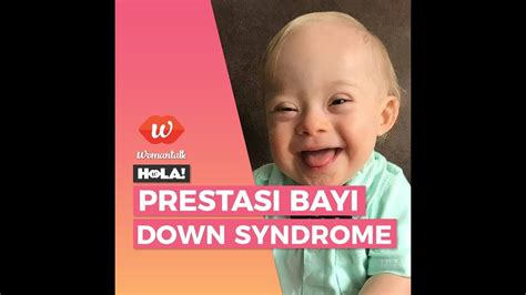 Dalam tes darah ibu yang disebut. Ciri Ciri Down Syndrome Pada Bayi - Ini Cirinya