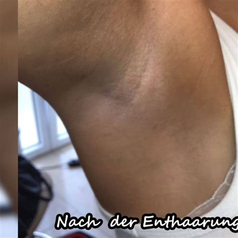 Tatsächlich können sie die zuckerpaste für sugaring zu hause ganz einfach selbst anrühren. Beauty Landshut | Sugaring