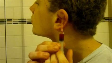 Your cat's ears may be able to pick up the sound of a bag of treats being opened across the house, but they could still use a little help staying clean. Epic Cauliflower Ear Drain - YouTube