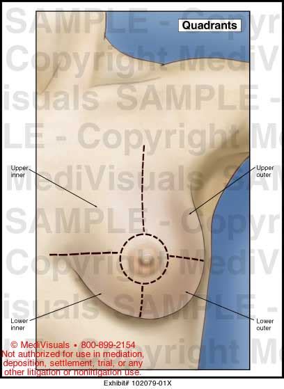 Dominant pathway (receives >75% of lymph from breasts) drains lateral quadrants of breast either directly or via sappey's plexus to axillary nodes Breast Quadrants Medical Illustration