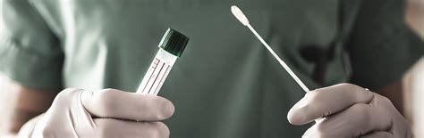 Kein test auf infektion oder infektiosität ist derzeit für den routineeinsatz verfügbar. PCR test - COVID 19 - at home | ASPY Salud on line