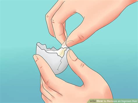 You can also apply a warm compress before shaving to help prevent ingrown hairs. 7 Effective Ways to Remove an Ingrown Hair - wikiHow