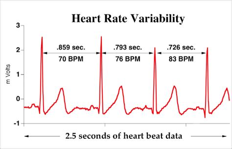 Heart rate variability reflects your nervous system. HRV Heart Rate Variability | Project inVictus