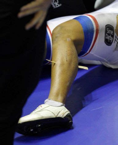 Dato' muhammad azizulhasni bin awang dpmt kmn amn (born 5 january 1988) is a malaysian professional track cyclist. MY KOPIEE@ BLOGGER: Picture/gambar azizul crash/accident ...