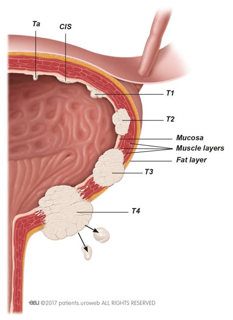 Does your dog suffer from bladder control issues? Muscle-invasive bladder cancer - PI