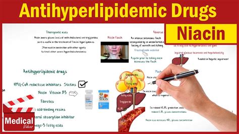 Summary carbimazole (cbz) is one of the major drugs currently used for the treatment of graves' disease. CVS 30- Antihyperlipidemic Drugs ( 2- Niacin Mechanism ...