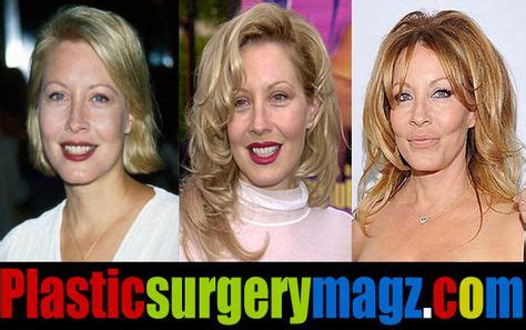 Linda Kozlowski Plastic Surgery Before and After | Linda ...