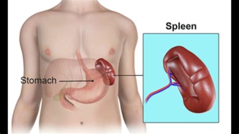 The liver is a large, meaty organ that sits on the right side of the belly. Spleen Surgery - Kenya Laparoscopic Surgery Services ...