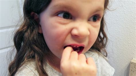 This will help preserve as much healthy tissue as possible while you wait to see a dentist. New Loose Tooth - YouTube