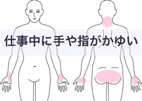 手のアトピー（症例2） | 川崎市多摩区のアトピー専門整体 ...