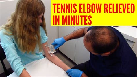 It's common in people who play sports such. Tennis Elbow Pain Relieved In Minutes With ASTR (REAL ...