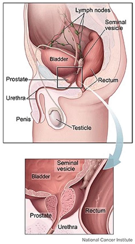 Camel active is an accessories company that is located in the country of kuala lumpur. What is Your Prostate? | Southwest Oncology Centers