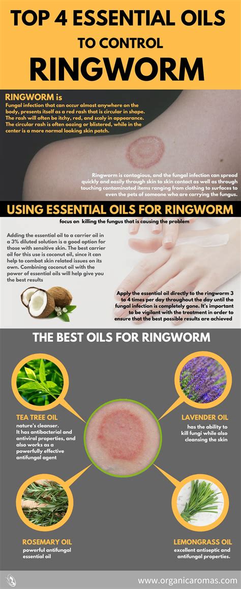 Does hand sanitizer kill ringworm : Does Hand Sanitizer Kill Ringworm / Ringworm Dermatologist ...