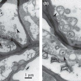 New growth is bright red and very vivid. (PDF) A new phytoplasma associated with witches'‐broom on ...