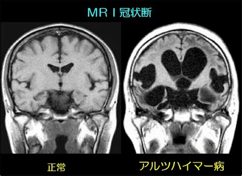 サスペンス / サスペンス・ミステリー / バイオレンス / ミステリー / 人情 / 家族 / 犯罪. アルツハイマー病の予防法は健康な生活を保つ方法でもあり ...