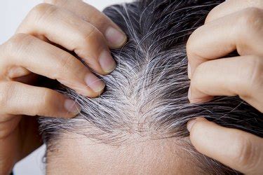 Unlike commonly thought of, only severe or chronic loss of proteins, iron, folic acid, vitamin b12 and copper can cause premature greying of hair. What Causes White Hair at a Young Age? | Livestrong.com