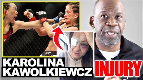 She currently fights for the ultimate fighting championship (ufc). Doctor Reacts To UFC Injuries : KAROLINA KOWALKIEWICZ Eye ...