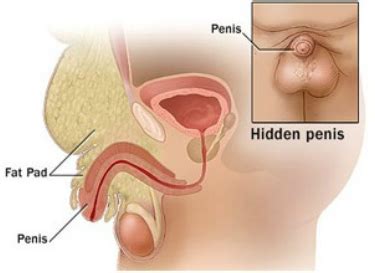 Cleaning regularly and maintaining good hygiene will be good fo your overall health, but knowing how to keep an uncircumcised penis from smelling can improve your sexual health too. Caliber (How to Increase Penis Size) - DNACANNON.COM