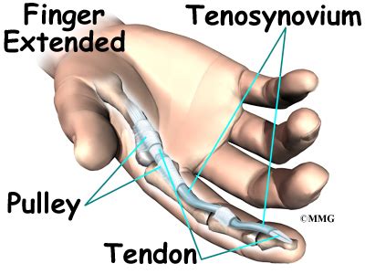 Tendons play an important role in the movement by transmitting the contraction force produced by the tendons are mainly composed of three parts: Trigger Finger and Trigger Thumb | eOrthopod.com