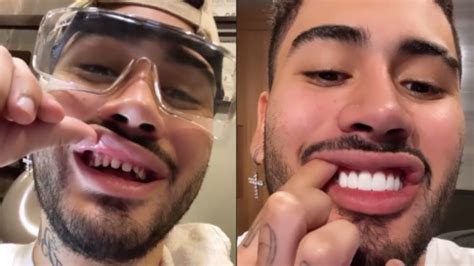 Mc kelvinho 2020 lançamento baixar mp3. Kevinho assusta fãs ao surgir sem lentes nos dentes: 'Que ...