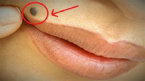 Maybe you would like to learn more about one of these? Anda Bakal Terkejut Jika Tahu Artinya Punya Tahi Lalat di ...