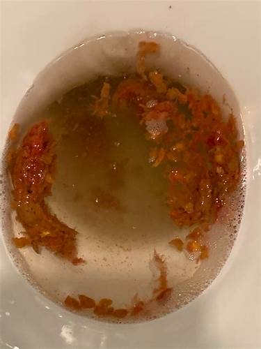 Длительная диарея диета Дискомфорт в животе - Вопрос гастроэнтерологу - 03 Онлайн Дискомфорт в животе - Вопрос гастроэнтерологу - 03 Онлайн Длительная диарея диета