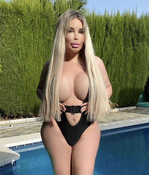 Jessica alves made a name of herself after spending thousands of pounds on plastic surgery to look like a ken doll. De voormalige 'Mens Ken Doll' Jessica Alves stroken neer ...