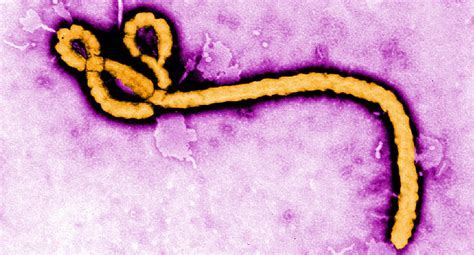 Ebola is a severe and often deadly disease caused by a virus. Ebola Virus: Symptoms, Treatment, and Prevention