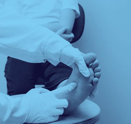 9 years ago no, you don't.'t was a pleasure to help. Footlab+ | Warts