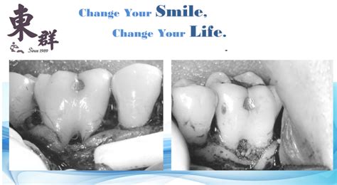 The site owner hides the web page description. 實際案例 | 東群牙醫聯盟 Tung Chun United Dental Clinics