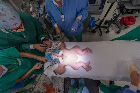 Jacksonville conjoined twins successfully separated ...