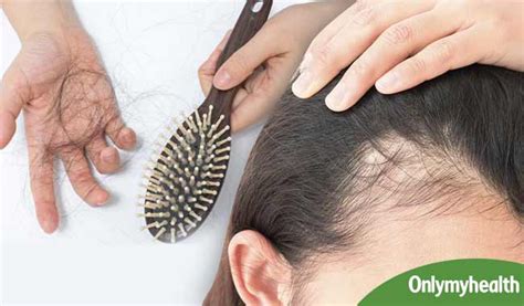Massage bhringraj oil directly by applying it directly on the scalp and leaving it overnight. Ayurvedic treatment for hair loss | Ayurvedic remedies for ...