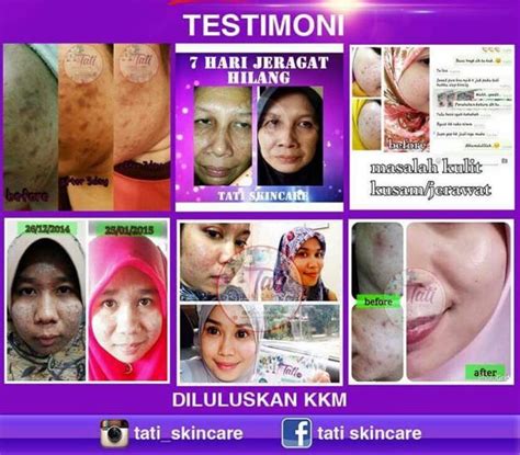 Deretan produk kosmetik dan skincare berbahaya, ada juga produk korea yang sering dipalsukan oleh bpom tahun 2018. Nurul Beauty Online: TATI SKINCARE : HAPUSKAN JERAWAT ...